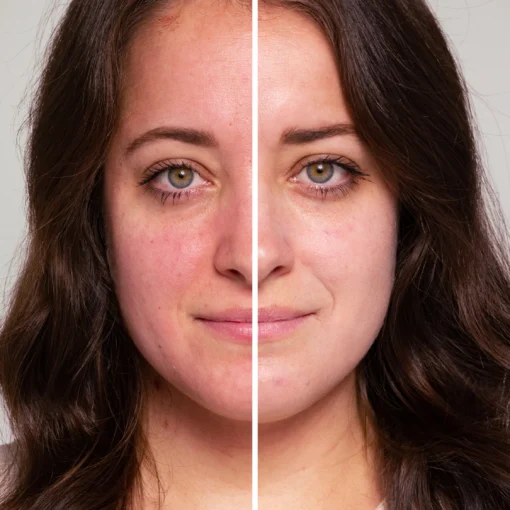HydroPure™ Color Correcting Serum - Image 4
