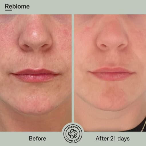 ReFence Tinted SunScreen SPF 30 50ml - Bilde 21