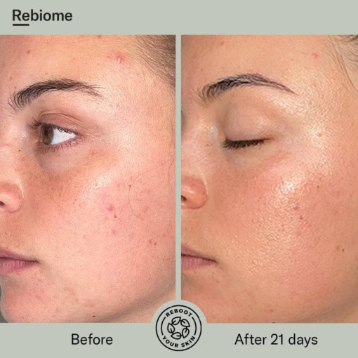 ReSurface Enzym Peeling 100ml - Bilde 5