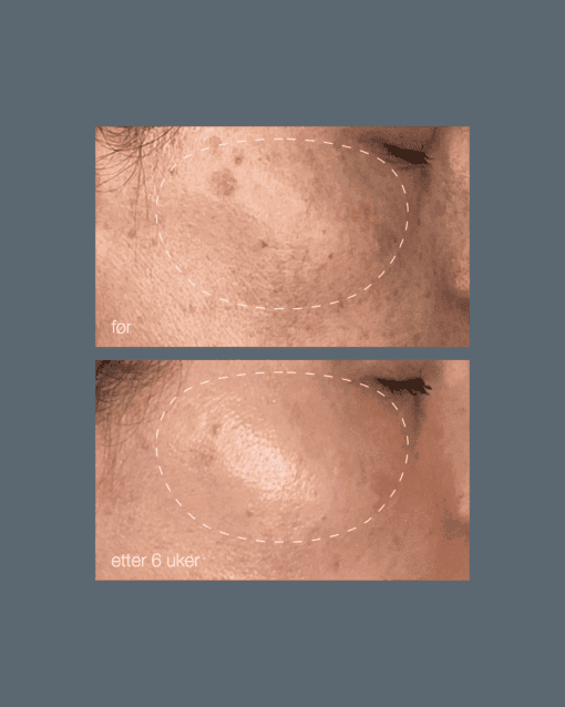 Micellar Prebiotic Precleanse - Image 27